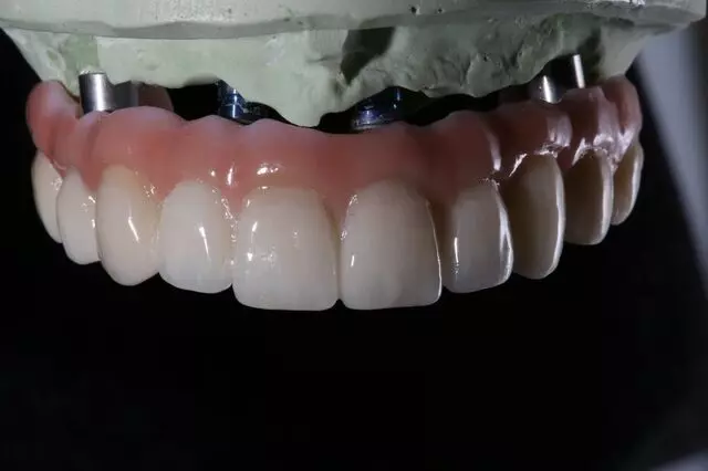 Implant Ninja Dental Center